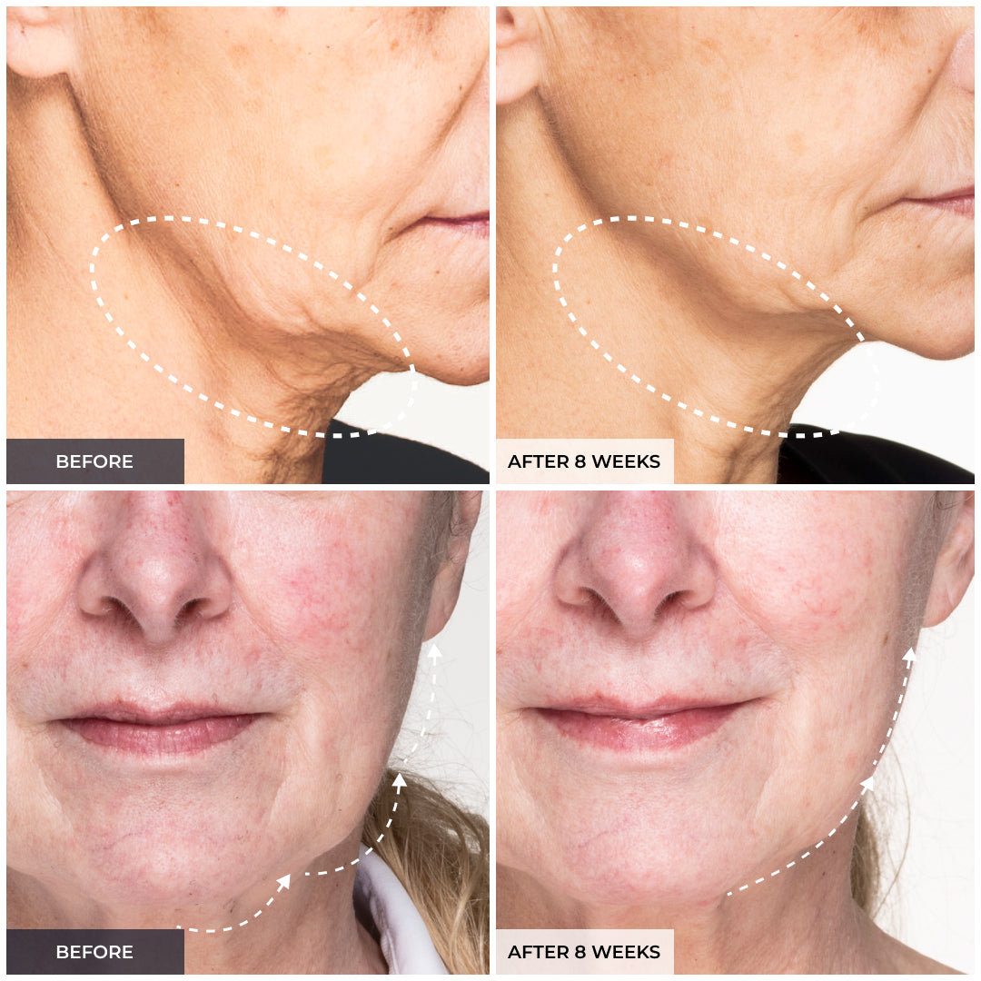 Luxe Lift Mask Set (White Pulse)