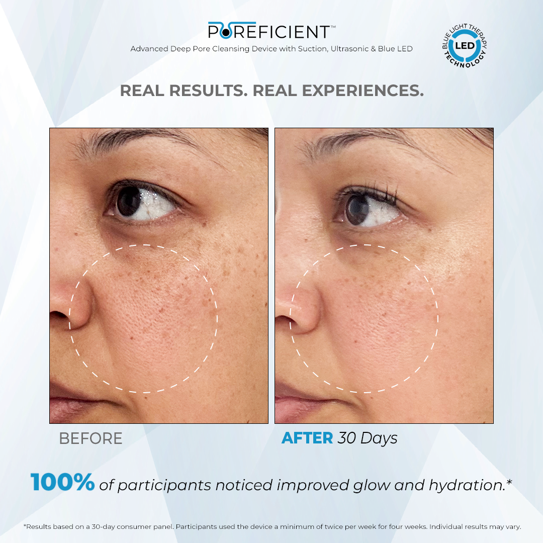 POREFICIENT™ Exfoliating Serum