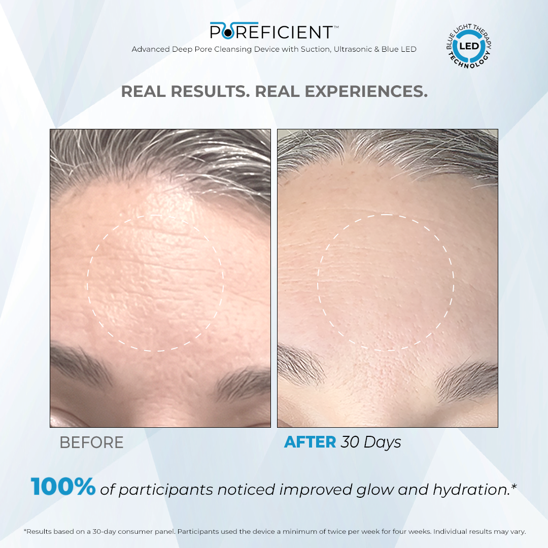 POREFICIENT™ Exfoliating Serum