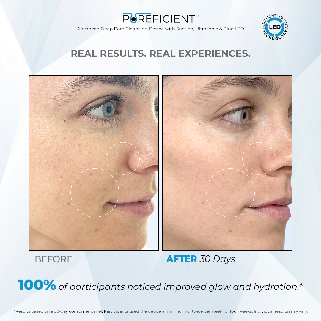POREFICIENT™ Advanced Deep Pore Cleansing Device with Suction, Ultrasonic & Blue LED